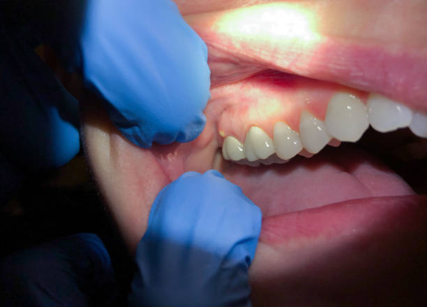 Best Emergency Dental Care for Broken or Chipped Teeth in Ele, AR