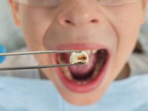 Best Pediatric Emergency Dentist in Ele, AR